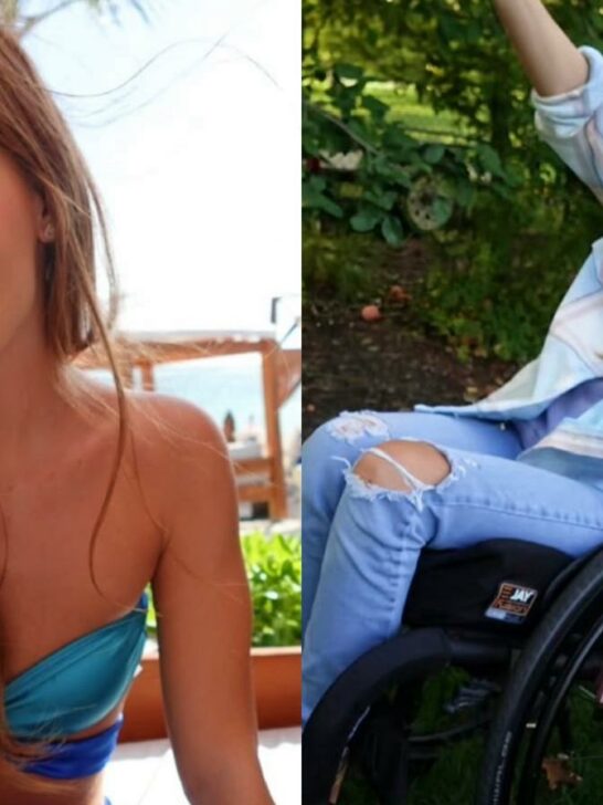 Scars, swimsuit, and refining beauty after injury- The importance of showing up for yourself 