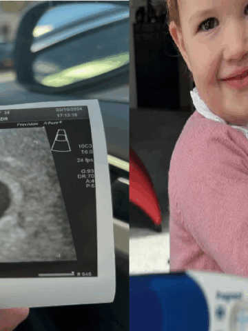 ‘I held my baby in my palm and cried. Mother poured out all that she felt after bidding her baby goodbye during pregnancy at 8 weeks.